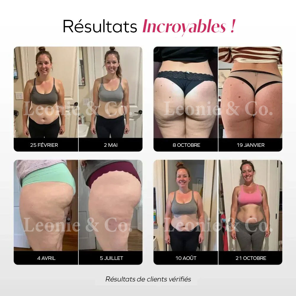 Tulancingo™ Leggings 3D Drenantes Anticelulíticos con Compresión